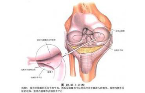 運(yùn)動醫(yī)學(xué)（關(guān)節(jié)鏡）?？? title=