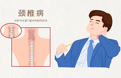 警惕！骨與關節(jié)的“健康危機”，你中招了嗎？